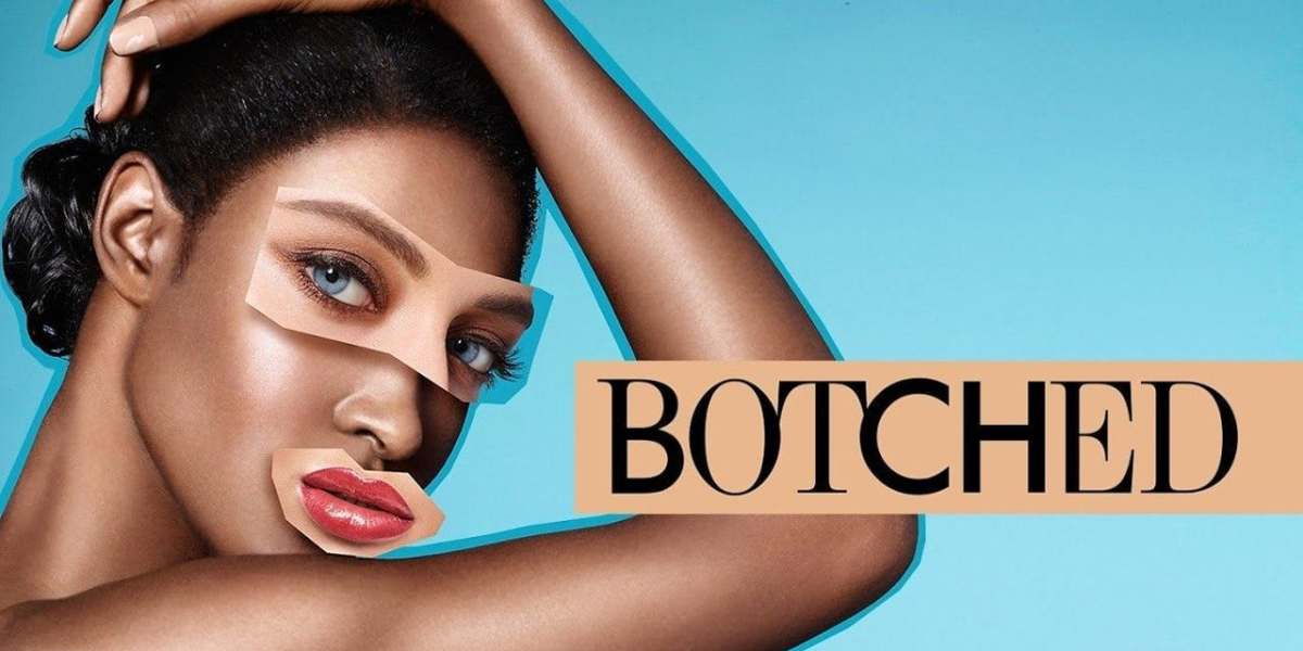 Botched - Season 7