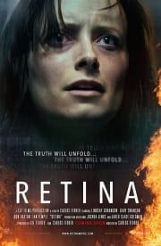 Retina