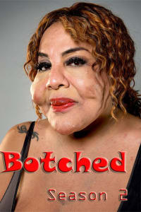 Botched - Season 2