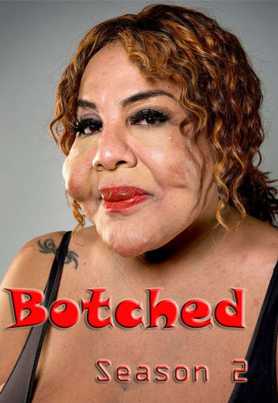 Botched - Season 2