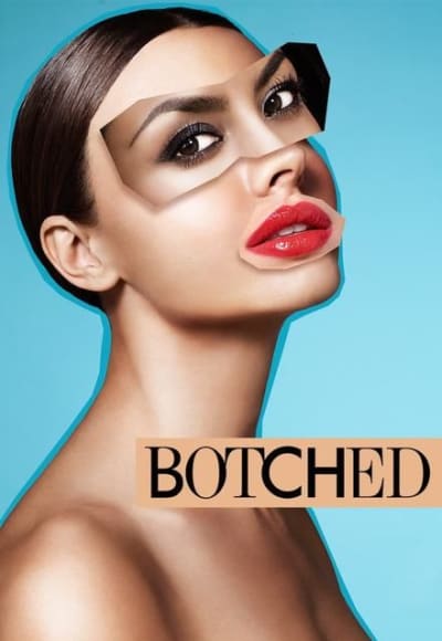 Botched - Season 4