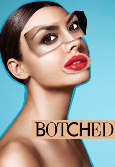 Botched - Season 7