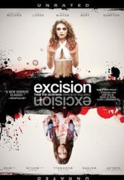 Excision