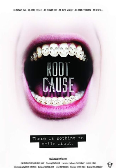 Root Cause